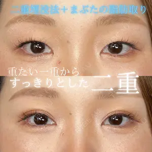 30 days after image