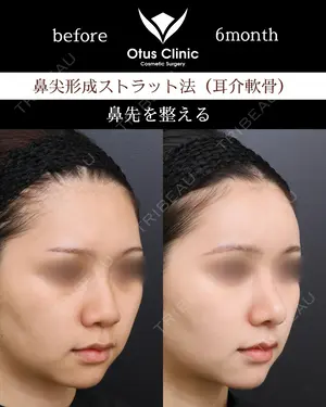 180 days after image