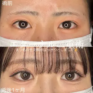 30 days after image