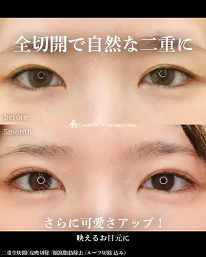 before image