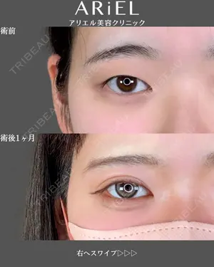 30 days after image