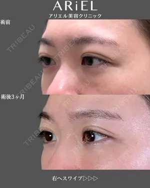 before image