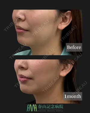 30 days after image