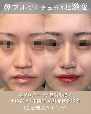 before image