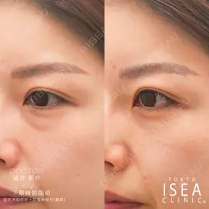 before image