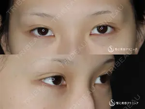 before image