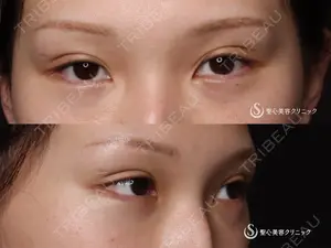 90 days after image