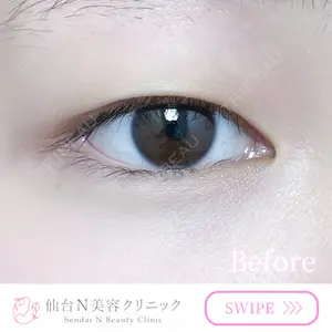 before image