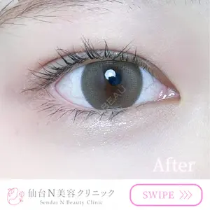 30 days after image