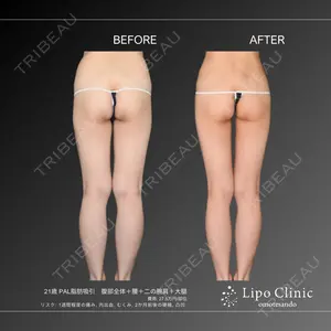 180 days after image