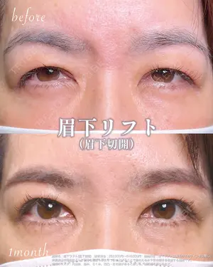 30 days after image
