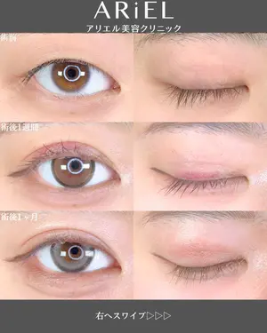 30 days after image