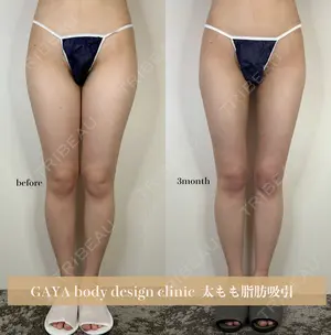 90 days after image
