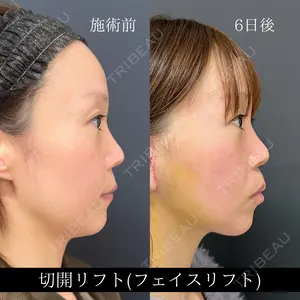 before image