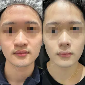 14 days after image