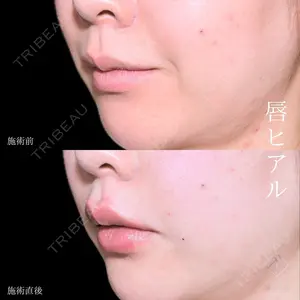 before image