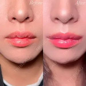 before image