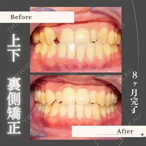 before image