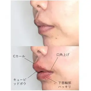 before image