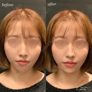 before image