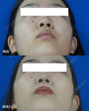 before image