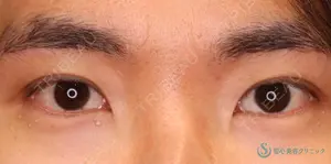 30 days after image