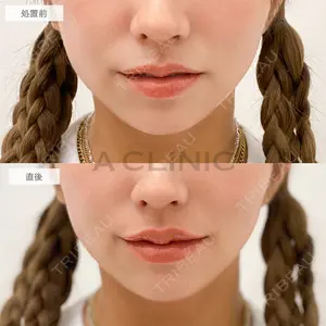 0 days after image