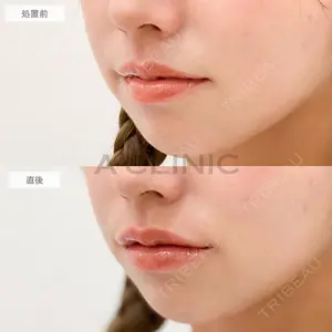 0 days after image