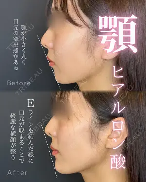 0 days after image