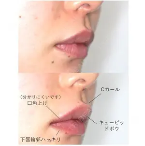 before image