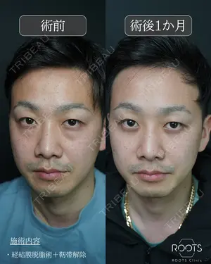 before image