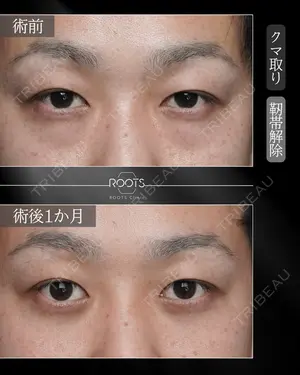 30 days after image