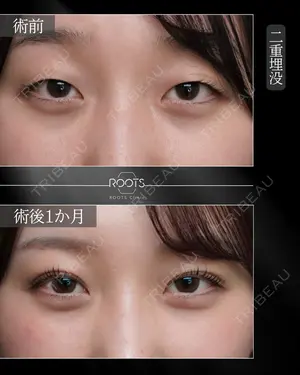 30 days after image