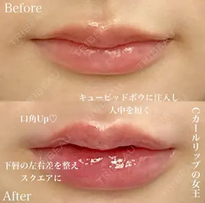 1 days after image