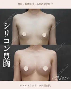 90 days after image