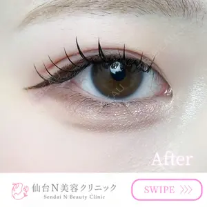 30 days after image