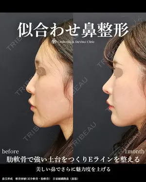 30 days after image