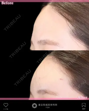 before image