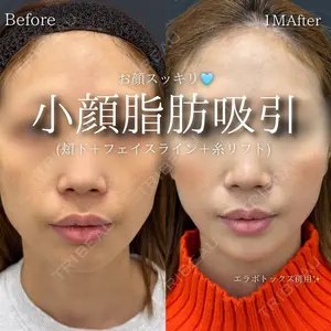 30 days after image