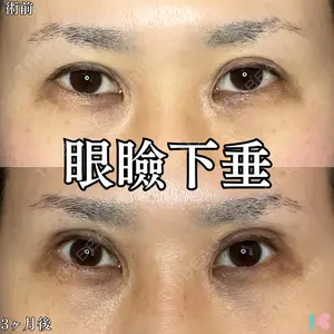 90 days after image