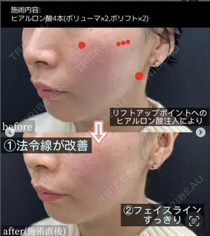 0 days after image