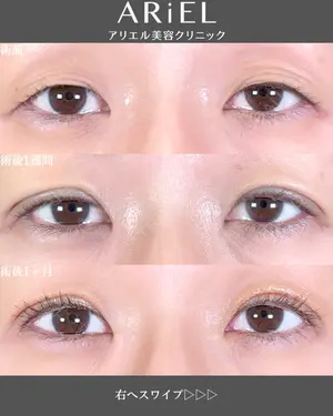before image