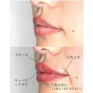 before image
