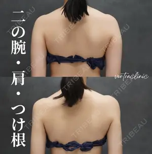 90 days after image