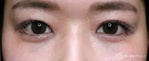 4 days after image