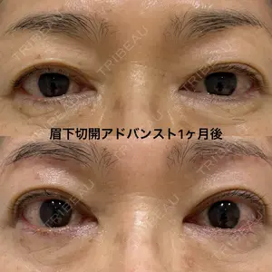 before image