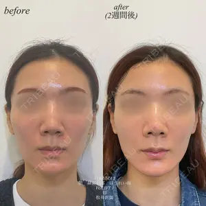before image