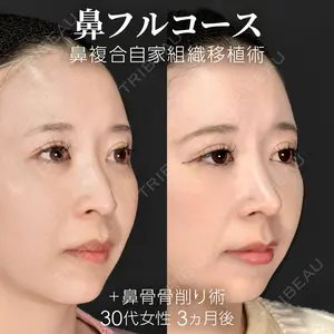 90 days after image