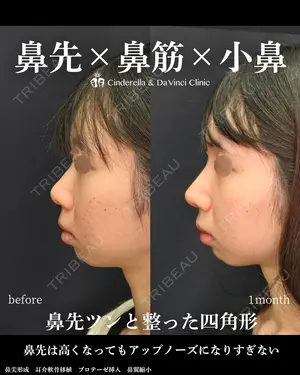 30 days after image