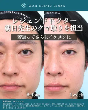 7 days after image